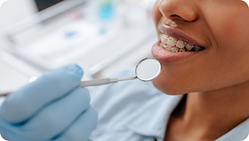 Person with clear ceramic braces getting a dental exam